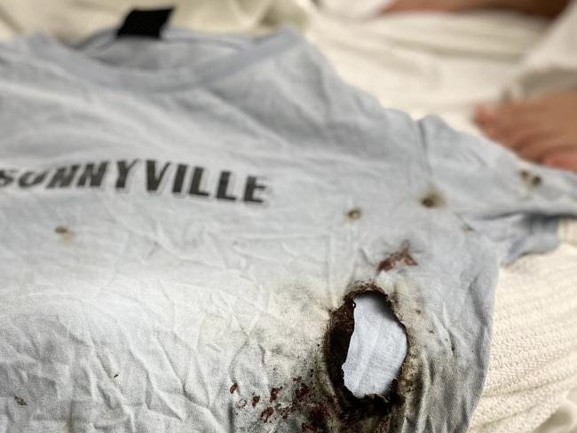 The shirt Elias Carrera, 11, was wearing when he was hit by a firework in the chest at a Christmas carols event on Allambie Heights Oval. Picture: Carrera family