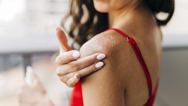 Skin expert shares 8 tips to fight against skin cancer and melanoma. Picture: Getty images