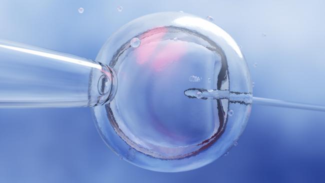 IVF (in vitro fertilisation) or insemination of female egg with microscope