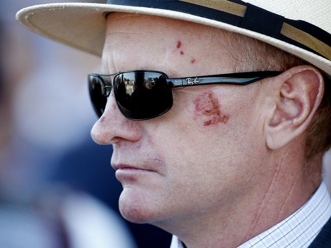 Trainer Phillip Stokes showing scars after being kicked by one of his two-year-olds earlier in the week. Picture: Michael Klein