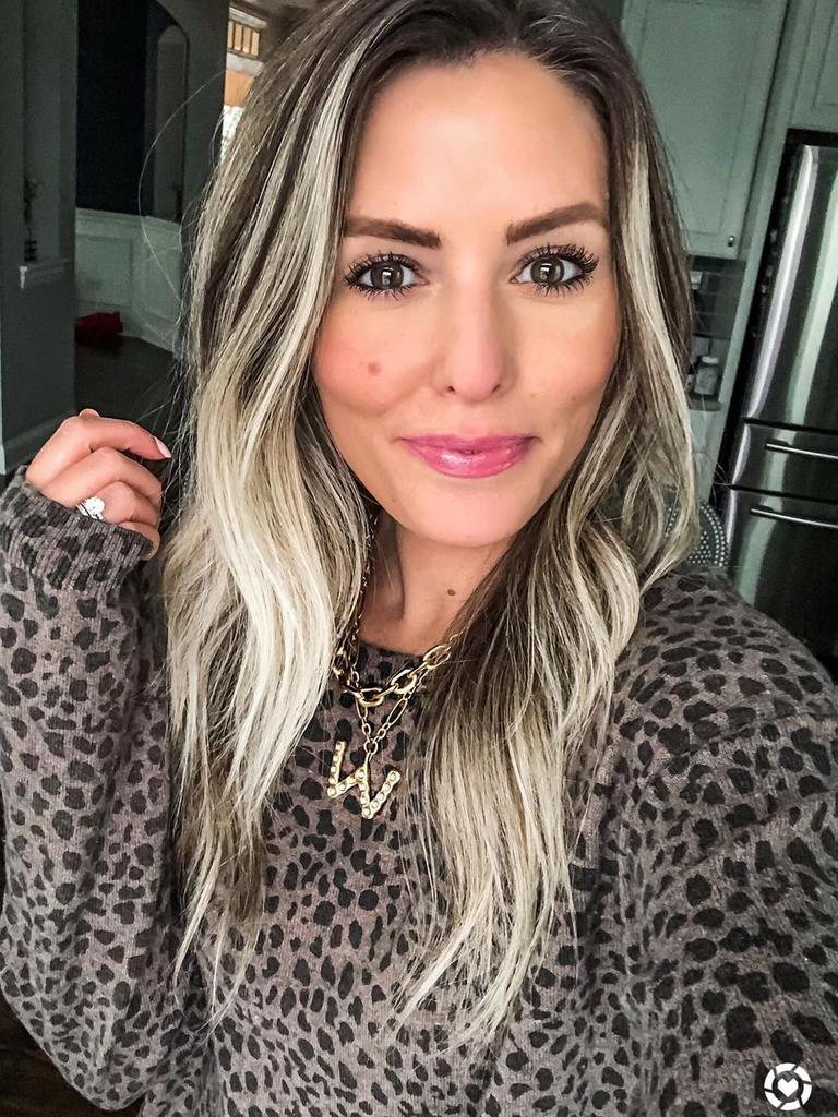 Whitney Buha has shared the results of her ‘bad Botox’ online. Picture: Instagram/SomethingWhitty