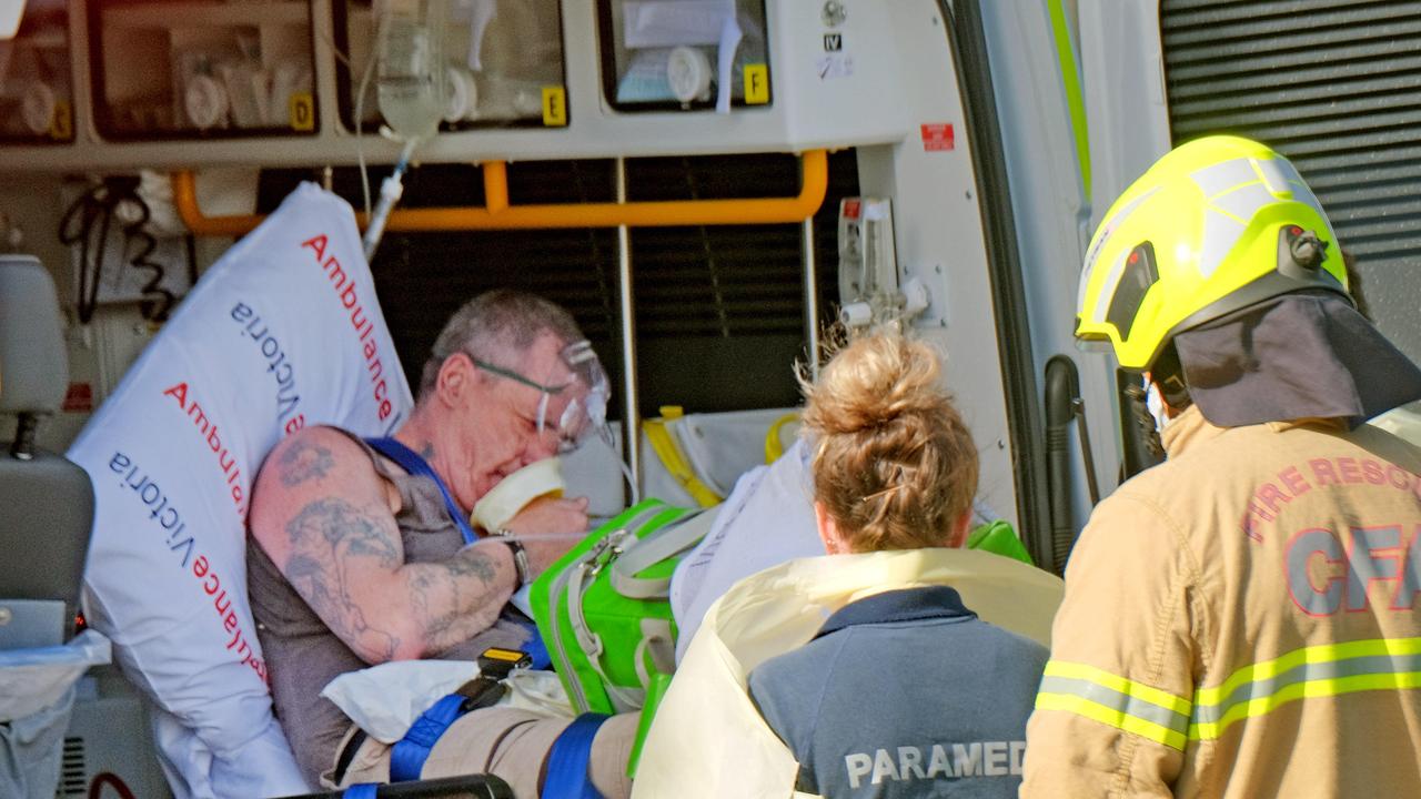 Thomas Findlay being treated after the fire. Picture: Mark Wilson