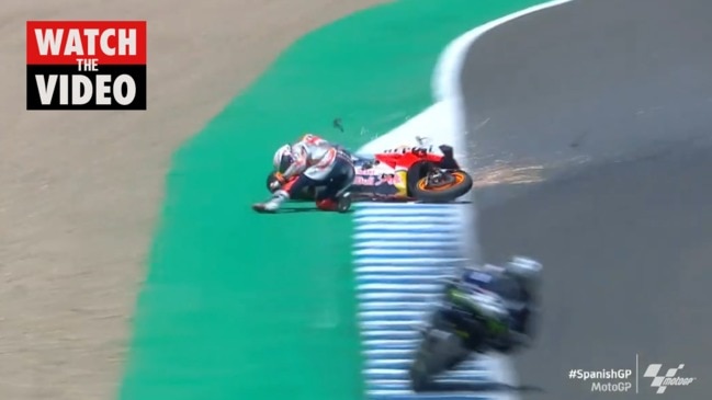 34+ Marc Marquez Arm Broken PNG