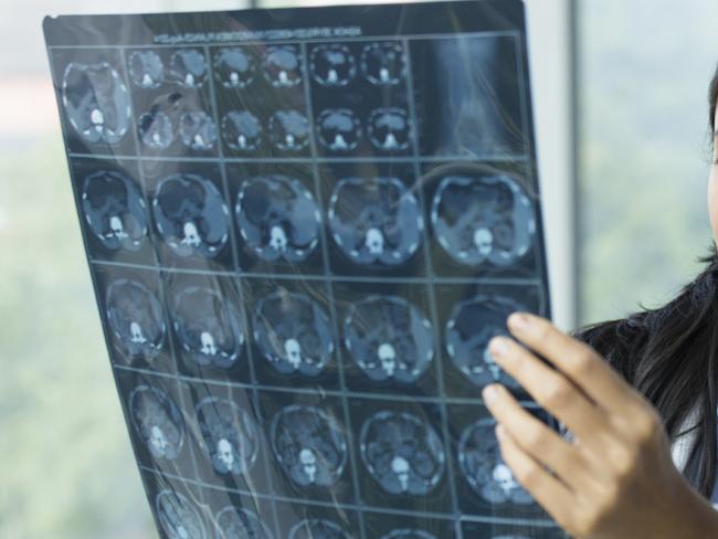 Generic photo in hospital - doctor looking at an xray (x-ray).  Picture: iStock