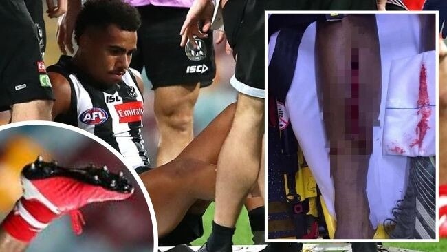 Isaac Quaynor was left with a serious leg injury.