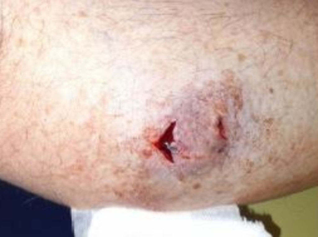 Ergon Energy is pleading with Queensland dog owners to properly restrain their pets after more than 270 attacks in the past two years. Picture: Contributed