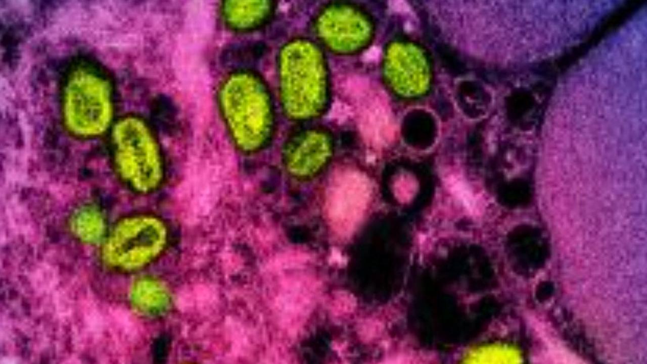 A colorised transmission electron micrograph of monkeypox particles (green) found within an infected cell (pink and purple). Picture: National Institute of Allergy and Infectious Diseases/AFP