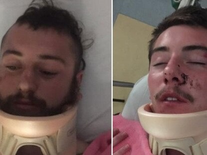 Lochie and Rueben HIggins were bashed in a supermarket car park . Pictures: Supplied