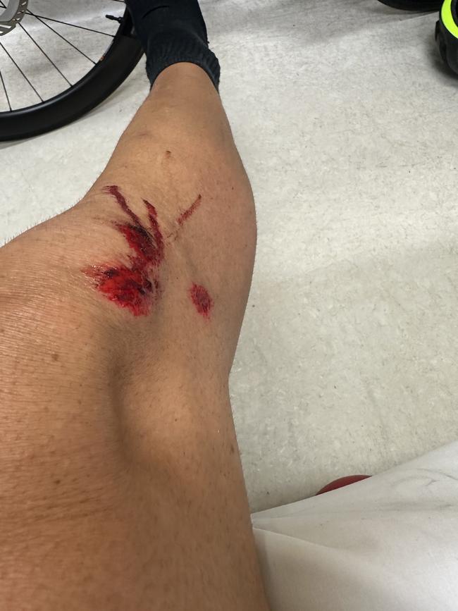 Pro cyclist survives Cairns hit-and-run, and is now advocating for a revival of Queensland's 'Share the Road' campaigns. Picture: Supplied.