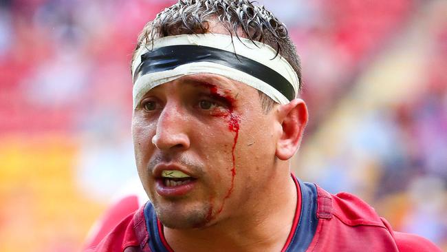 Reds prop JP Smith was in the wars against the Lions.