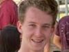 Teen rips handful of hair from victim’s head in drunken fight