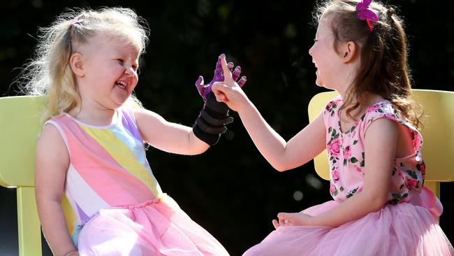 Izabella Carlson, 3, high-fives her sister Olivia with her new 3D printed hand. Pics Adam Head