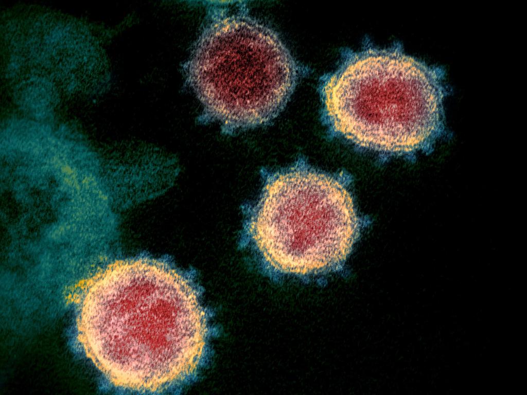 A transmission electron microscopic image that shows the original virus that causes COVID-19, isolated from a patient in the US, as the Virus particles are shown emerging from the surface of cells.