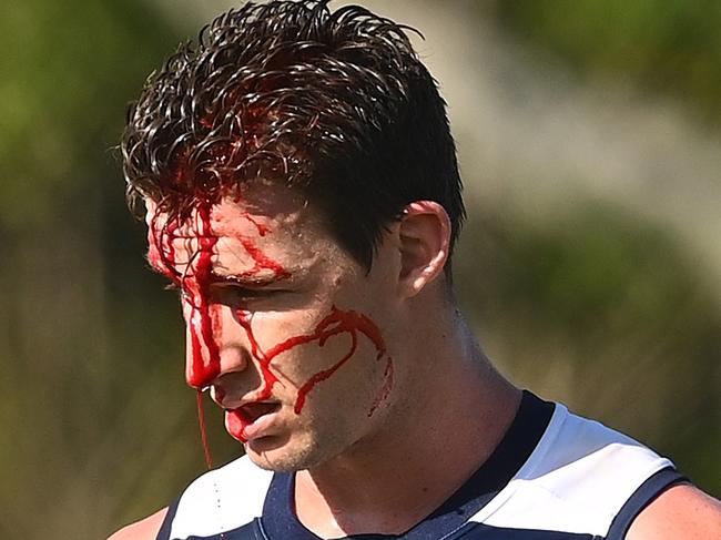 GOLD COAST, AUSTRALIA - SEPTEMBER 21: Josh Jenkins of the Cats comes from the field bleeding after a collision with Charlie Constable of the Cats during an AFL scratch match between the Geelong Cats and the Western Bulldogs at Metricon Stadium training ovals on September 21, 2020 in Gold Coast, Australia. (Photo by Quinn Rooney/Getty Images)