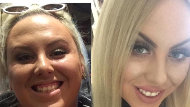 Brittany Jade Ofsoski has lost 58kg in eight months, but now she needs surgery to remove the excess skin. Picture: Instagram/Ofsoski