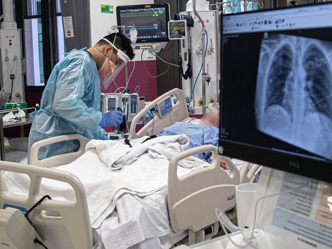 A patient is treated in the intensive care unit of Sunshine Hospital in Melbourne on Tuesday. Picture: Aaron Francis