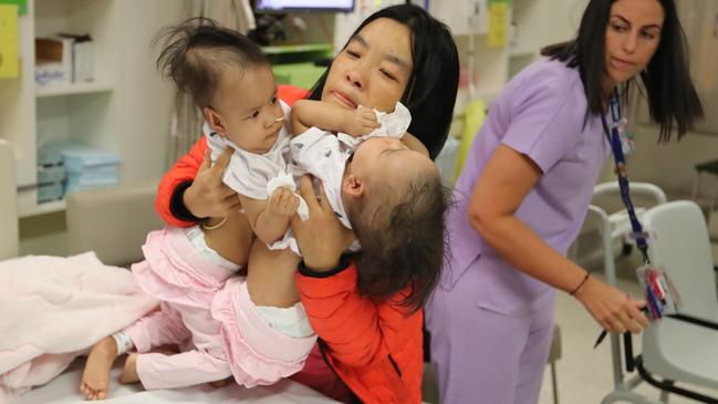 The Bhutanese conjoined twins, Nima and Dawa, prior to their successful surgery. Picture: Alex Coppel