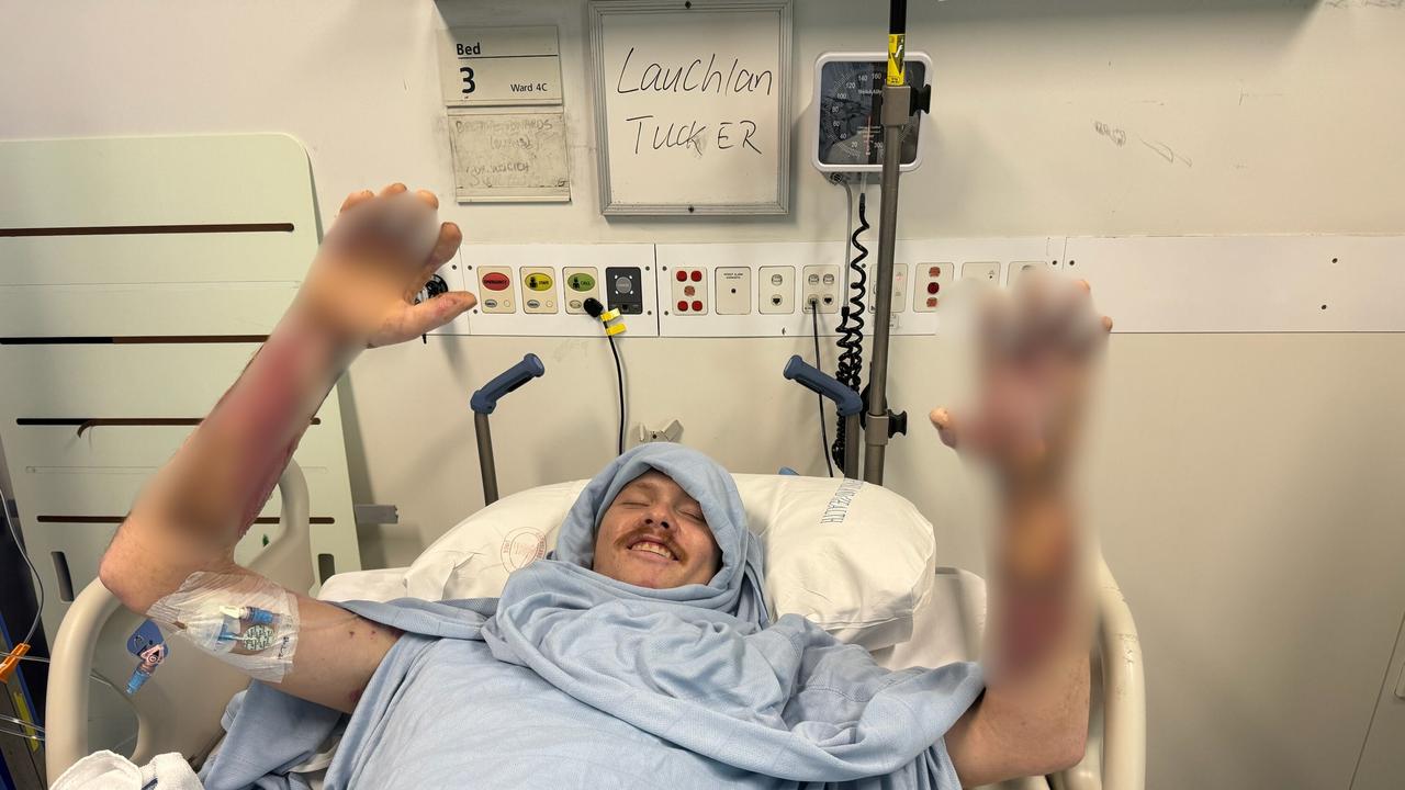Dalby roofer Lauchlan Tucker suffered catastrophic burns after a metal batten he was holding struck an overhead powerline.
