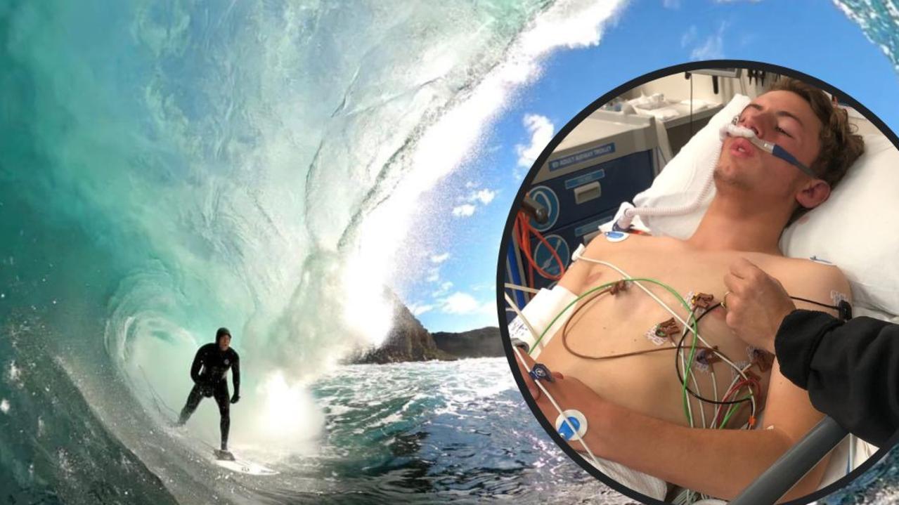 Harry Hollmer-Cross was injured after wiping out on a wave at Shipstern Bluff in Tasmania.