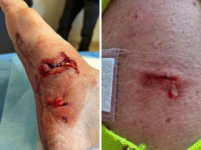 Australia Post is now equipping its postie's with a citronella spray to deter aggressive dogs after a spate of serious attacks across Queensland. Photo: Aus Post