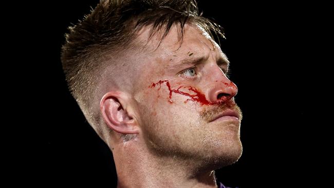 PENRITH, AUSTRALIA - AUGUST 15: Cameron Munster of the Storm leaves the field for a HIA test during the round 24 NRL match between Penrith Panthers and Melbourne Storm at BlueBet Stadium, on August 15, 2024, in Penrith, Australia. (Photo by Brendon Thorne/Getty Images)