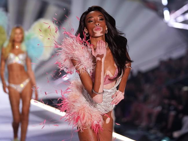 Winnie Harlow. Picture: AFP