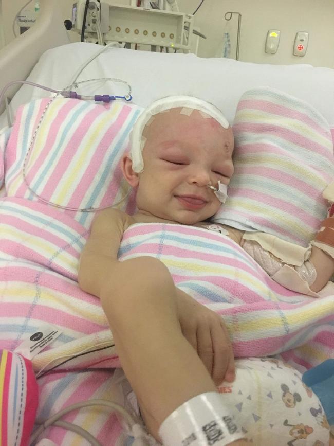 Little Patrick Murphy wakes up from dangerous brain surgery with a smile on his face.