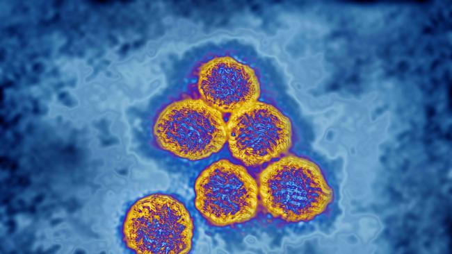 Flavivirus (family Flaviviridae), these viruses are responsible for yellow fever, dengue fever, Japanese encephalitis, Zika virus, West Nile encephalitis. They are transmitted by mosquitoes or ticks. image produced from transmission electron microscopy (viral diameter approximately 40 to 60 nm). (Photo by: CAVALLINI JAMES/BSIP/Universal Images Group via Getty Images)