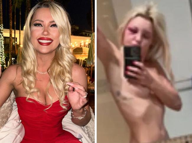 Model ‘unrecognisable’ after ‘sex slave’ ordeal. Picture: Instagram/NewYorkPost