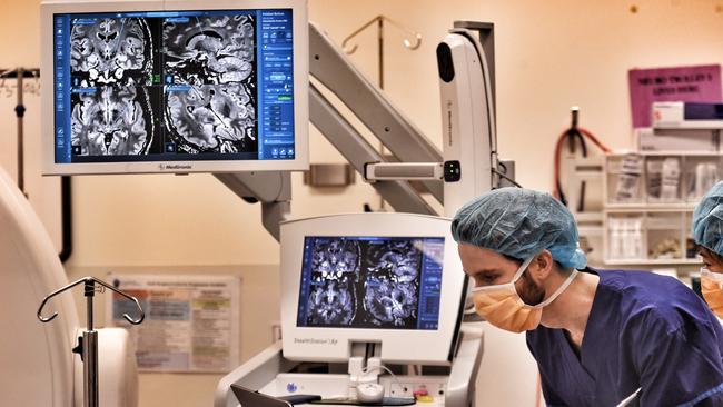 Doctors perform surgery on a Parkinson's disease sufferer. Picture: Tony Gough