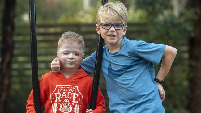 Miller Pennicott, 9 (right), is donating his stem cells to help brother Harrison, 7, in his fight against scleroderma. Picture: Andy Brownbill