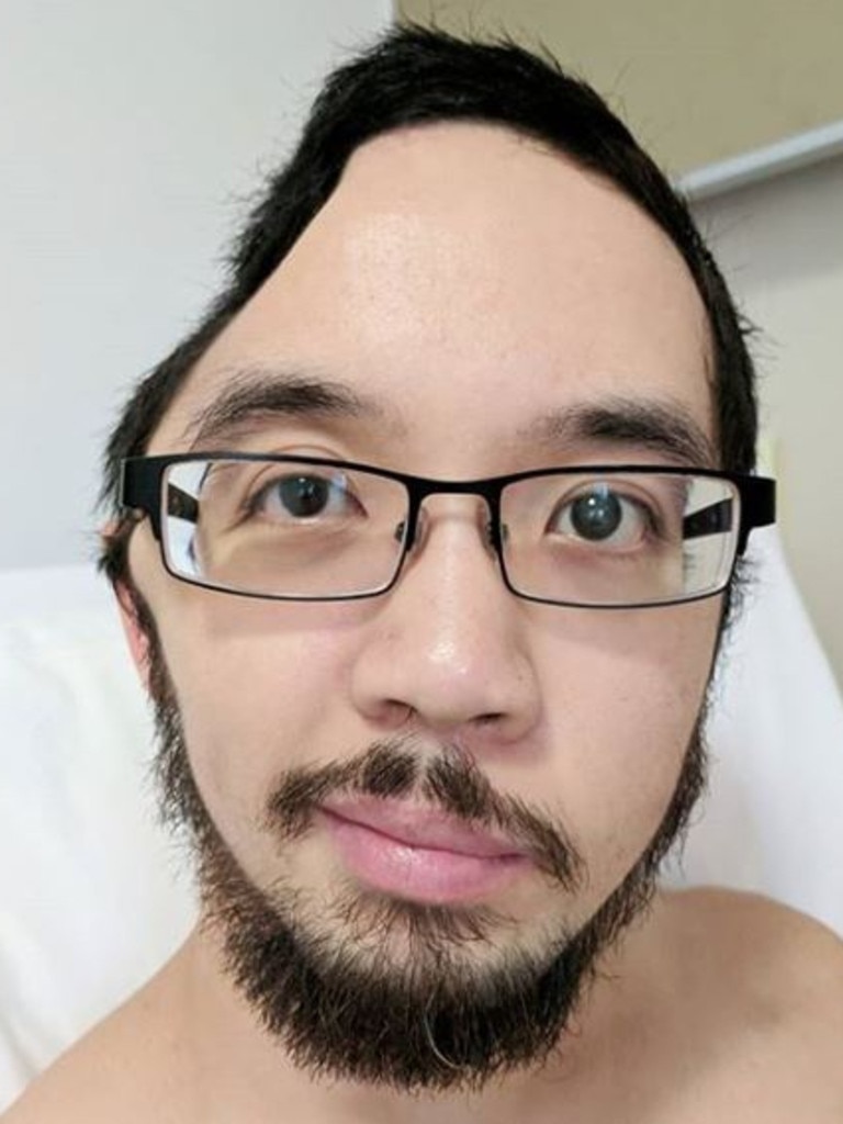 Nathan Nguyen after surgery.