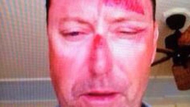 Australian golfer Robert Allenby feels lucky to be alive after he was kidnapped, beaten and robbed in Honolulu on Friday night.