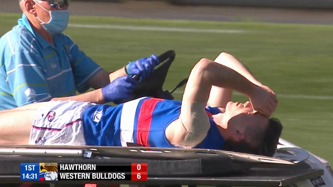 Toby McLean was carted off with fears of a serious knee injury.