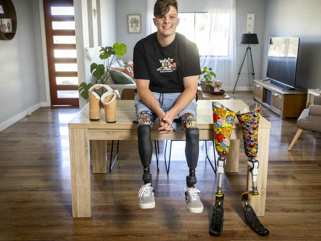 Ted at home with his first and last set of prosthetics. Picture: Jake Nowakowski
