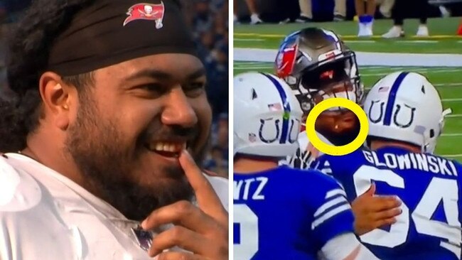 Vita Vea lost a tooth during his NFL game.