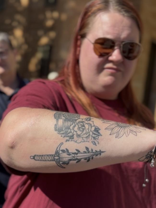 One of the alleged victims of the horrific Mount Jagged crash shows a scar along her arm. Picture: Charlie Dadds