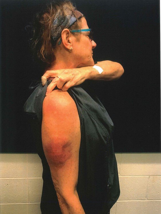 Nurse Lorraine Walcott was injured when the ambulance sent to attend to Kumanjayi Walker was pelted with rocks. Picture: Courts NT