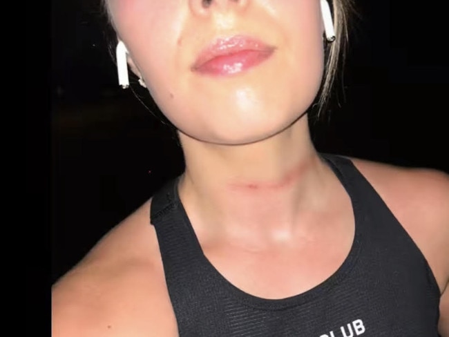 Reality star and F45 trainer, Leesh Cunningham was left with injuries to her neck after a dangerous encounter on her morning run.  Picture: Instagram