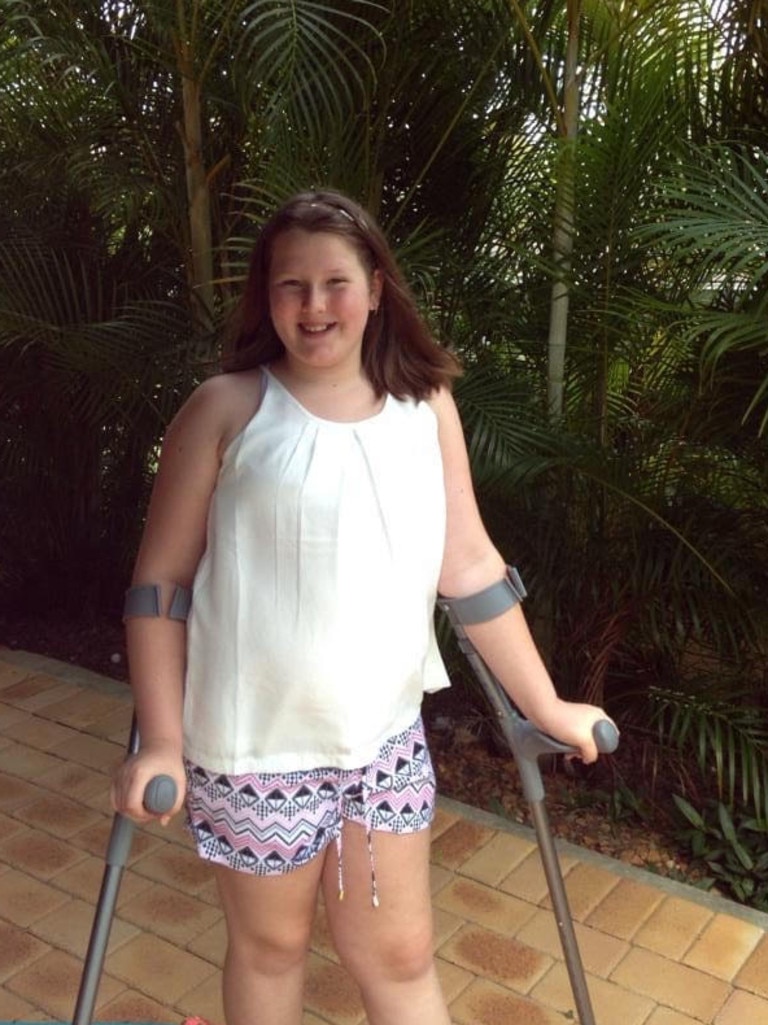 Ellie's EDS meant she's had 8 hip surgeries since she was 10. Picture: Supplied/Ellie Baxter