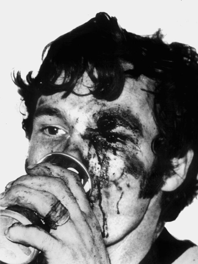 A bloodied Francis Bourke in 1980.