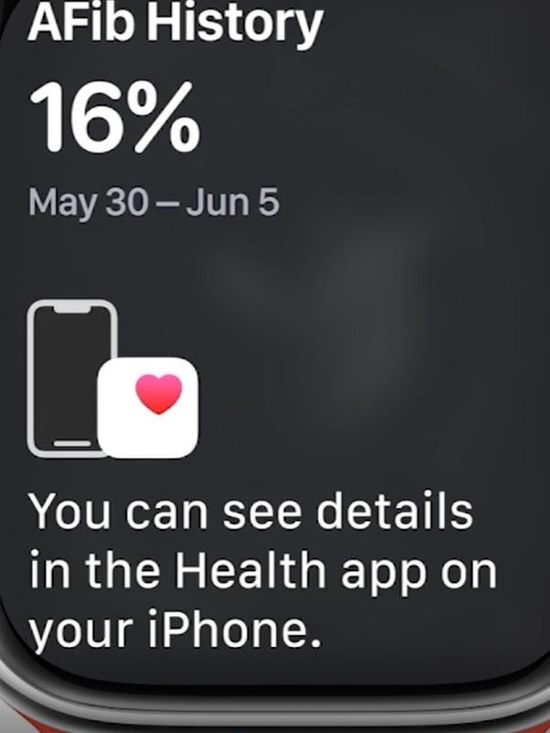 Apple's more expansive personal health details includes tracking the history of any atrial defibrillation.
