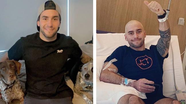 Josh Robson before and after he started chemo treatment for testicular cancer. Picture: Instagram /@robie92_onenut