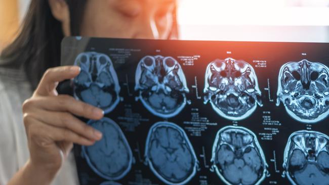 You may be surprised to learn that dementia is not a specific disease. Picture: iStock