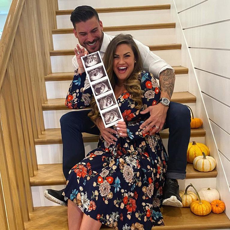 Vanderpump Rules’ Jax Taylor and Brittany Cartwright share sonogram of ...