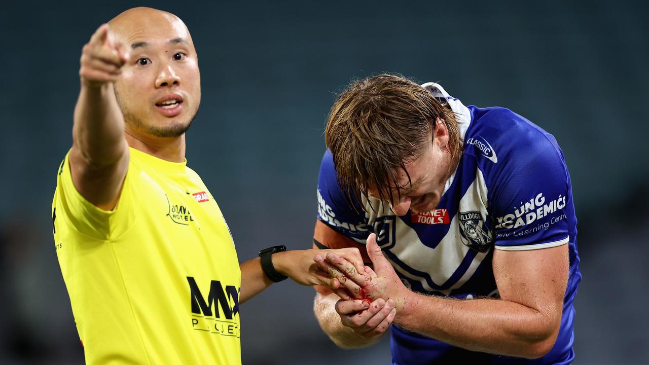 Jacob Preston treated for a finger injury. Picture: Getty