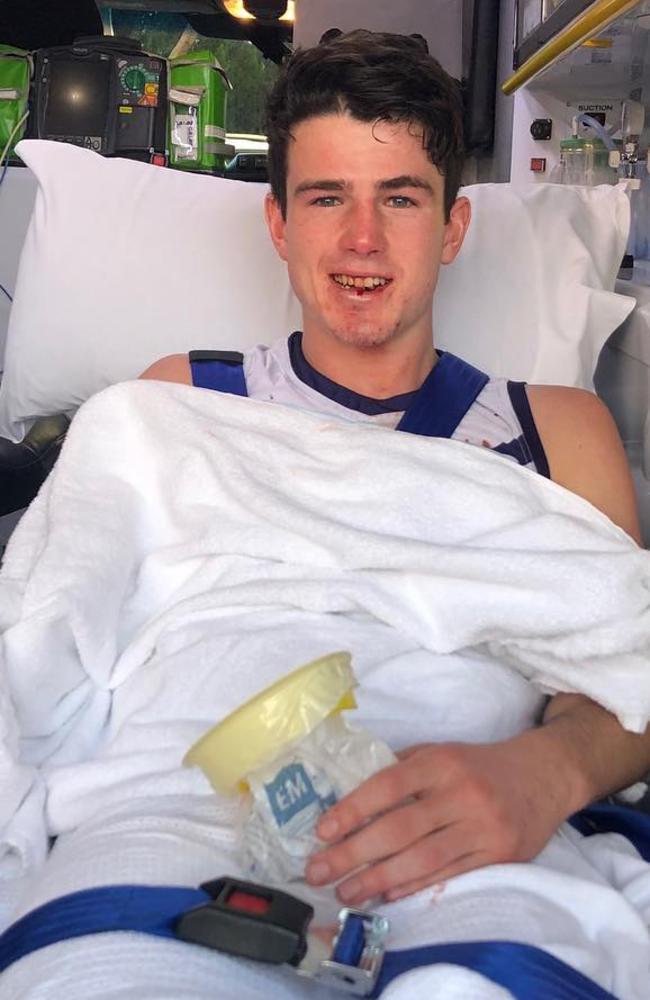 Andrew Brayshaw in an ambulance after he was punched by Andrew Gaff. Source: Instagram