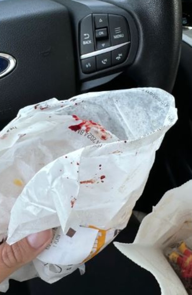 She said there was blood all over her burger, its wrapper, and her daughter’s toy. Picture: Tiffany Watson