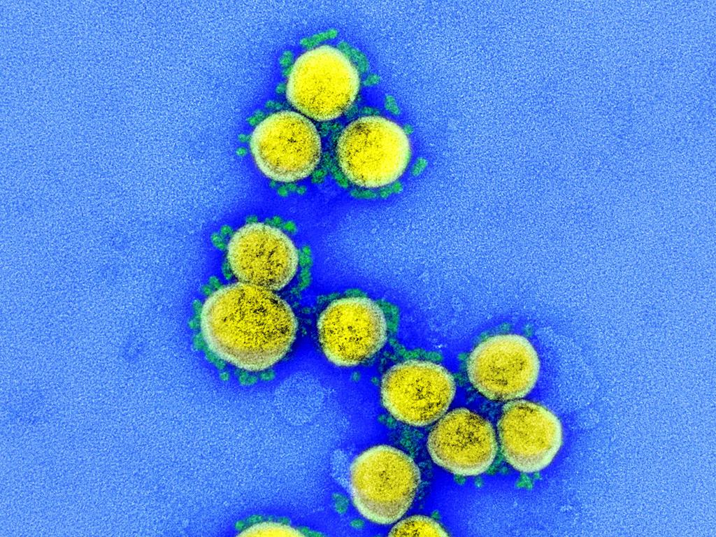 SARS-CoV-2 virus particles, isolated from a patient, captured and colour-enhanced at the NIAID Integrated Research Facility (IRF) in Fort Detrick, Maryland. Picture: National Institute of Allergy and Infectious Diseases / AFP