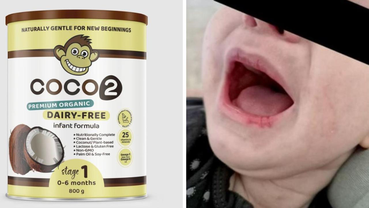 Parents left horrified after formula error
